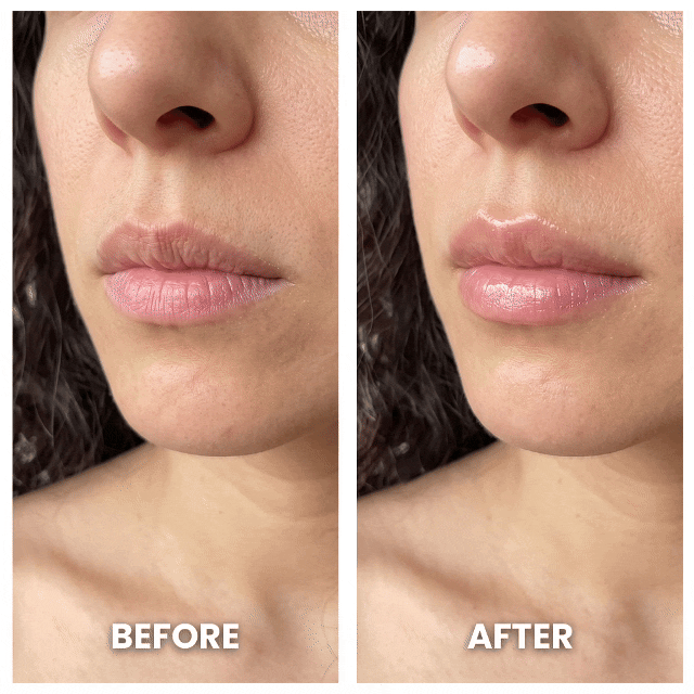 Dermalea VoluGlow PDRN Collagen Multi-Balm