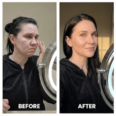 Dermalea ProSculpt™ Neck & Face Lifter.