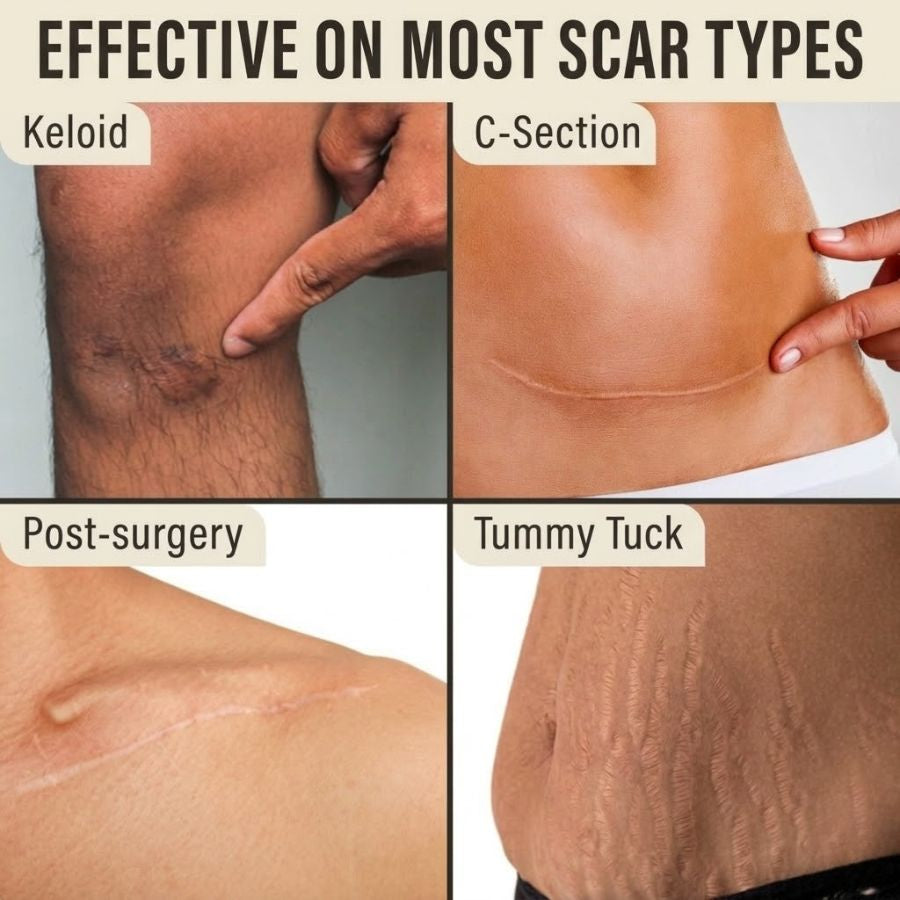 Dermalea DermaShield™ Pro Scar Matrix