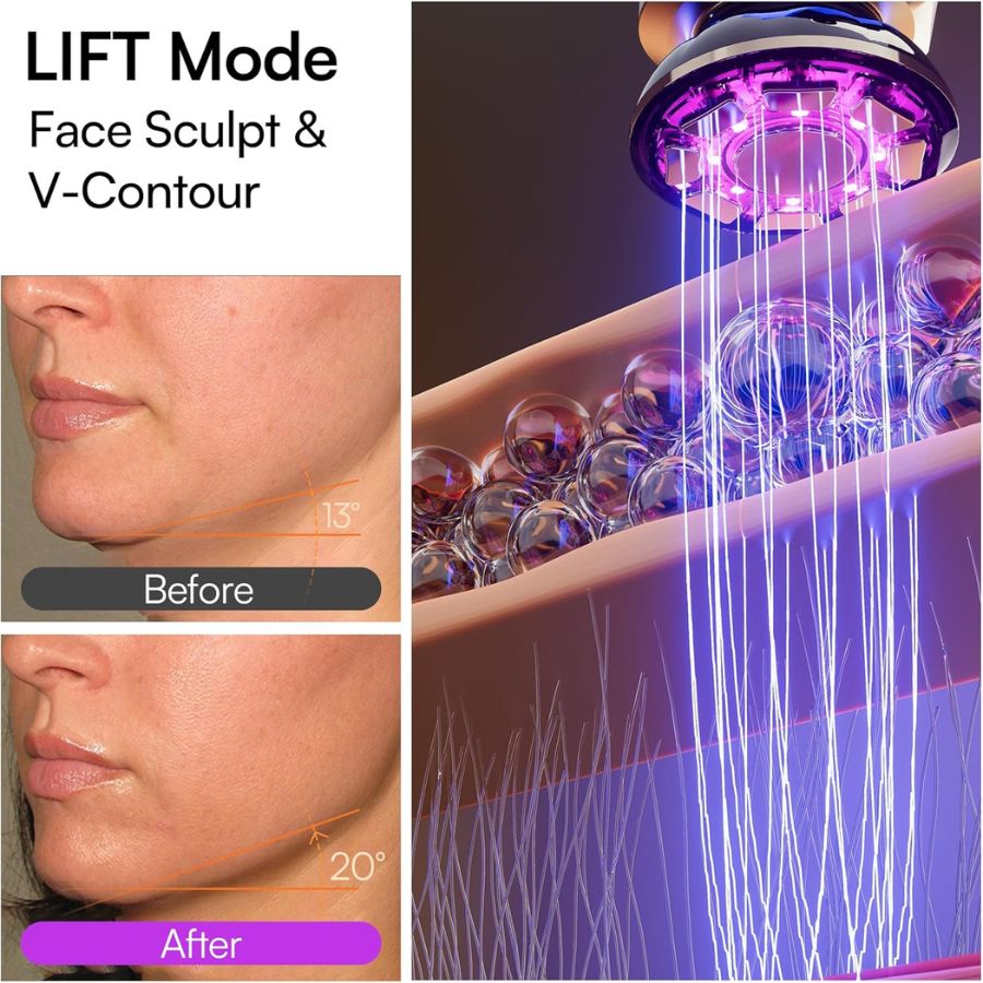 Dermalea ProSculpt™ Neck & Face Lifter.