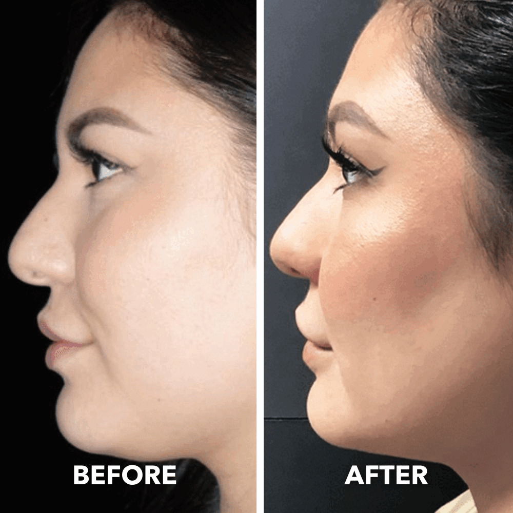 Smart Face Sculpting Device - 8 Modes Double Chin Reducer & Jawline Definer.