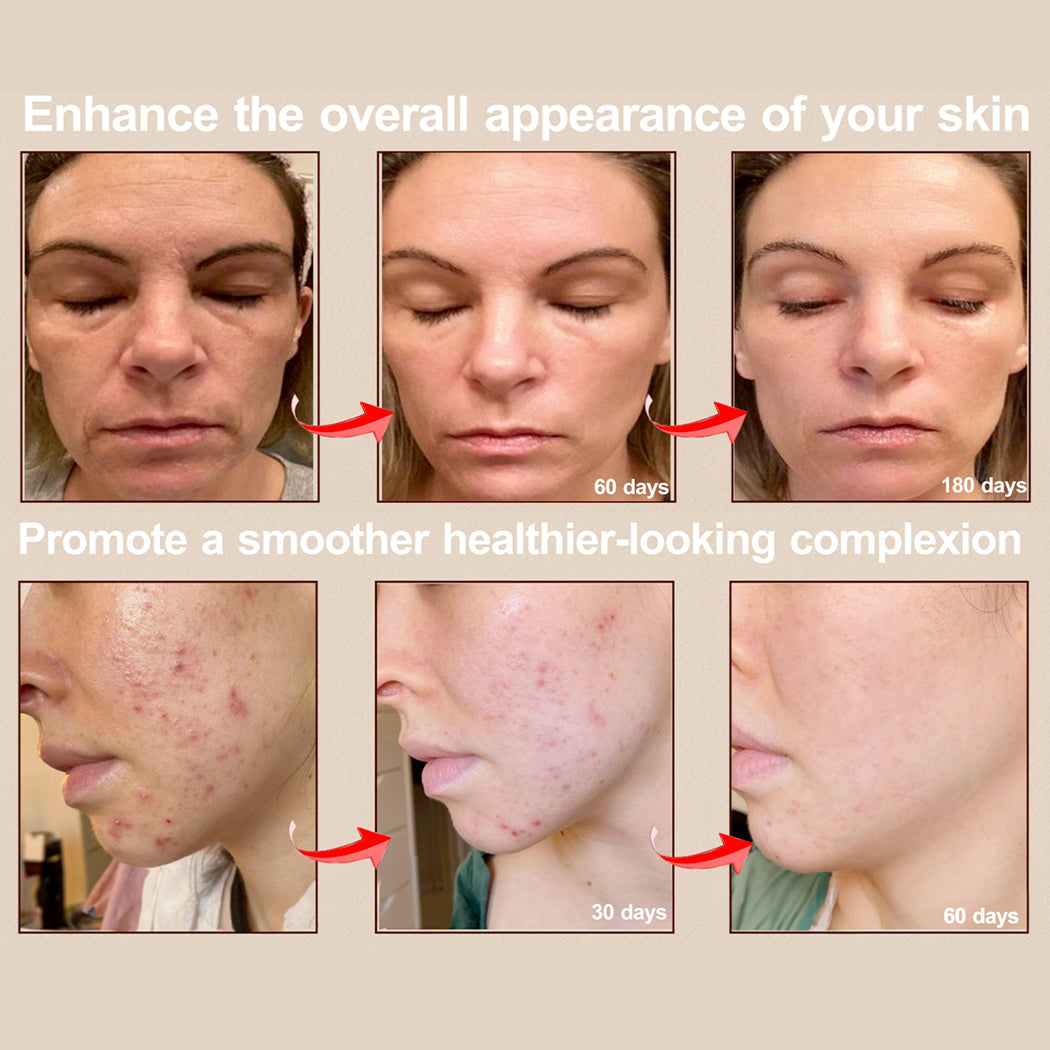 DERMALEA LUXE™ Pro Max LED Therapy Mask System Special Offer