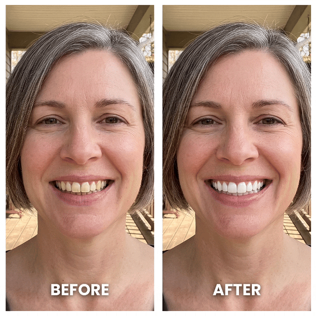 Dermalea Pro-White Oral Clarifying Therapy