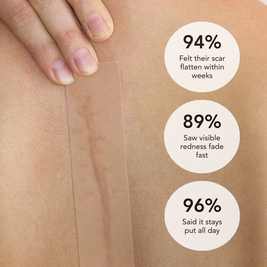 Dermalea DermaShield™ Pro Scar Matrix