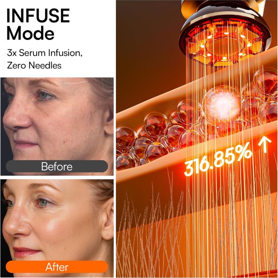 Dermalea ProSculpt™ Neck & Face Lifter