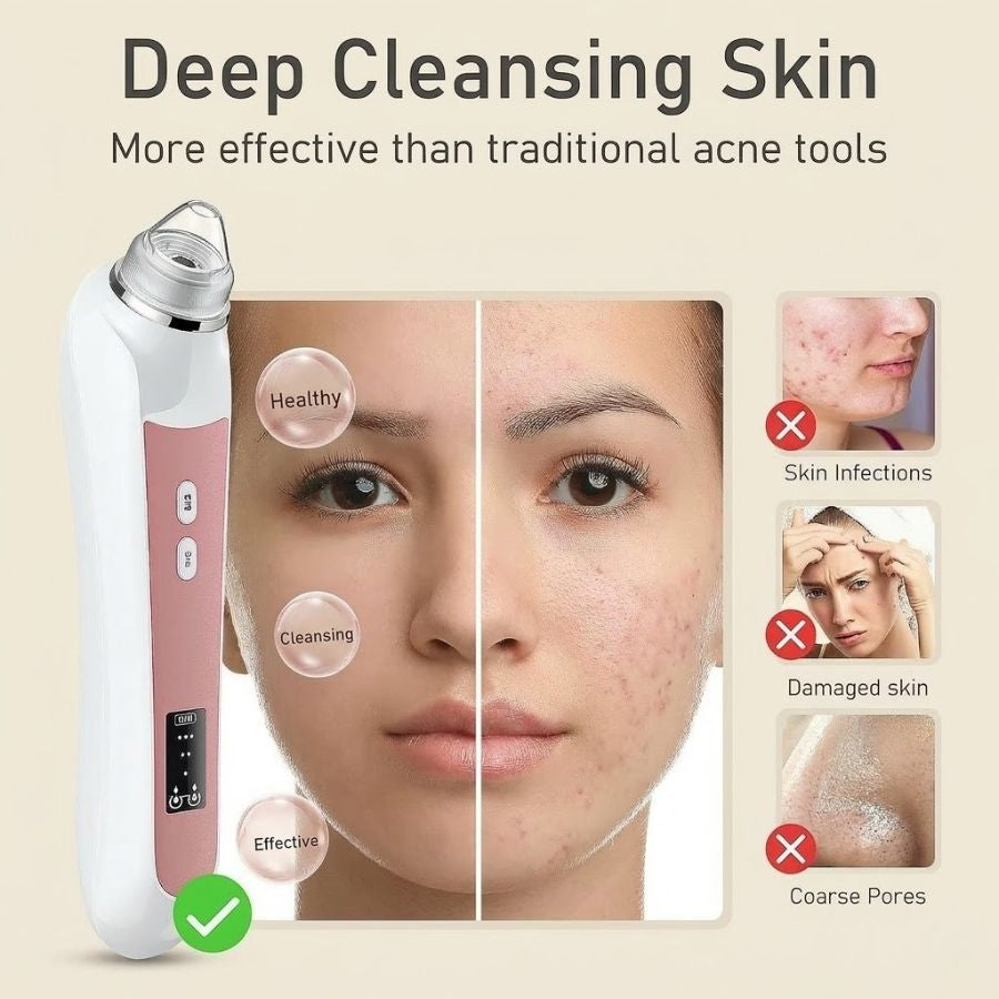 Dermalea VisionPro™ Smart Pore System